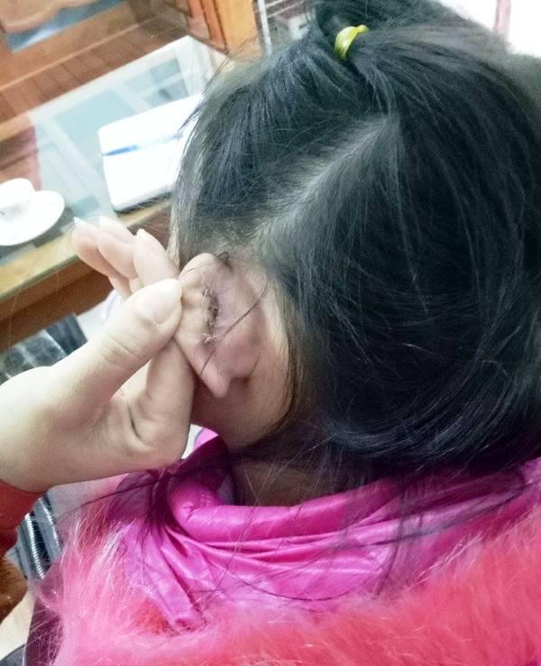 Học sinh bị xách rách tai mắt xích 4 mũi, hiệu trưởng nói nghe phong thanh - Ảnh 1. Học sinh bị xách rách tai khâu 4 mũi, hiệu trưởng nói nghe phong thanh - Ảnh 1.