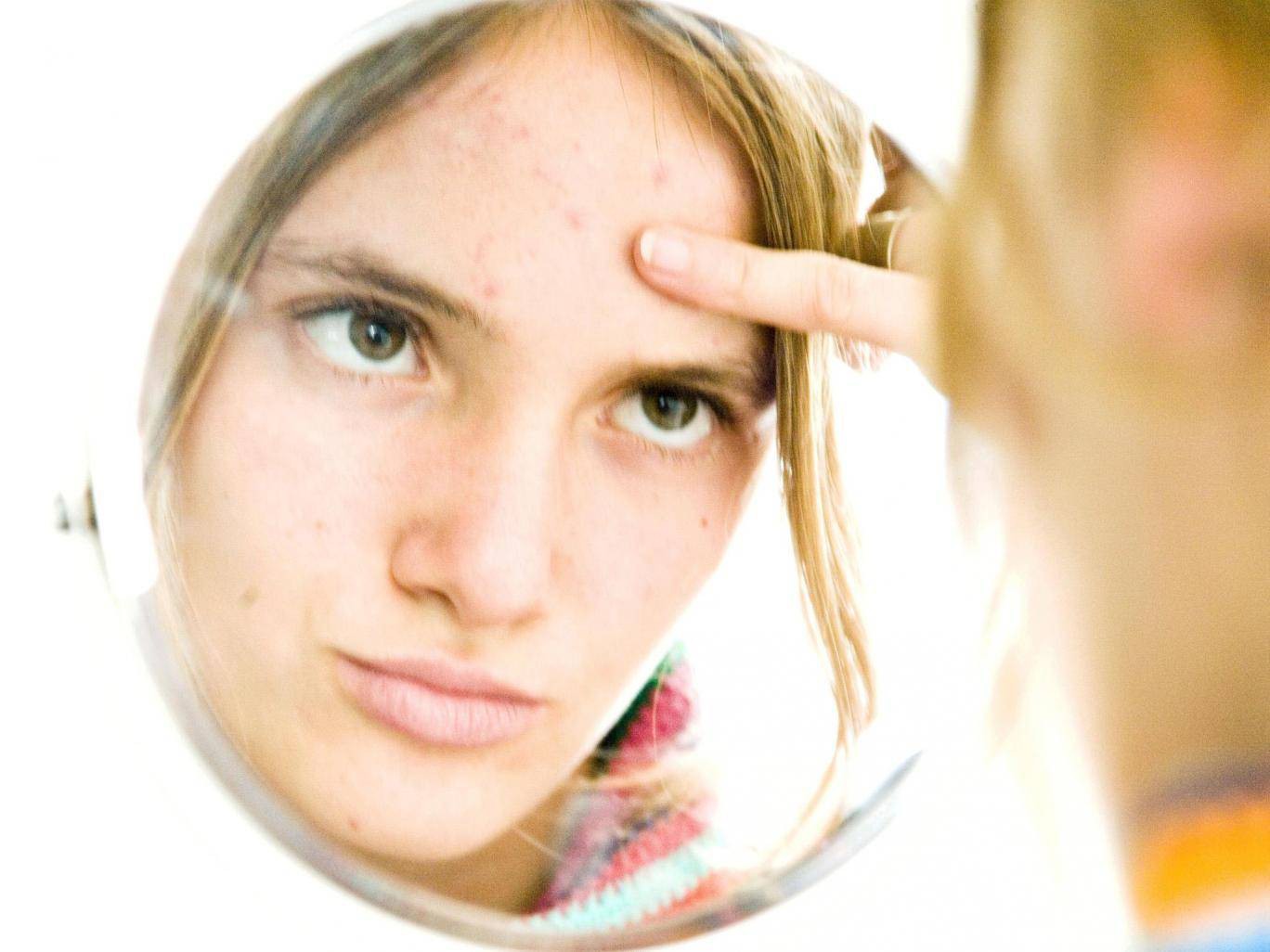 Trị mụn bằng... vàng - Ảnh 1. Trị mụn bằng... vàng - Ảnh 1.