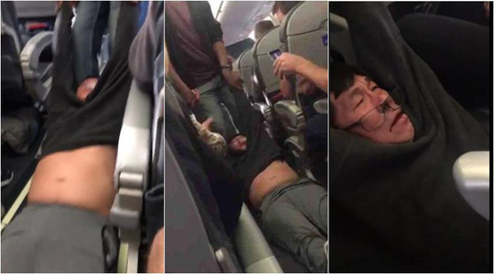 
Vụ việc người đàn ông 69 tuổi bị kéo lê khỏi máy bay của hãng United Airlines khiến dư luận bức xức. Ảnh: Facebook

 
