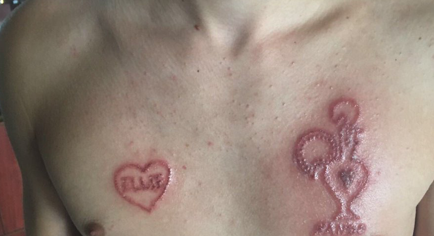 H&igrave;nh xăm tạm thời: Nguy hiểm nếu n&oacute; m&agrave;u đen - Ảnh 1.