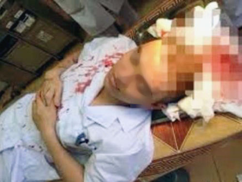 
Bác sĩ Lê Quang D. bị bố bệnh nhi hành hung phai khâu 7 mũi trên đầu - Ảnh: ANTĐ
