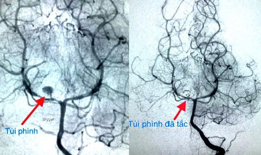 Căn bệnh hiếm gặp cực nguy hiểm ở trẻ nhưng không dễ phát hiện - Ảnh 1.