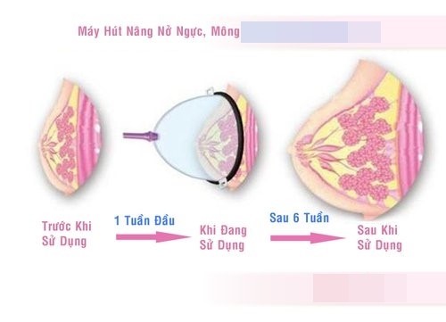 “Tiền mất tật mang” với những kiểu làm đẹp trên mạng - Ảnh 5.