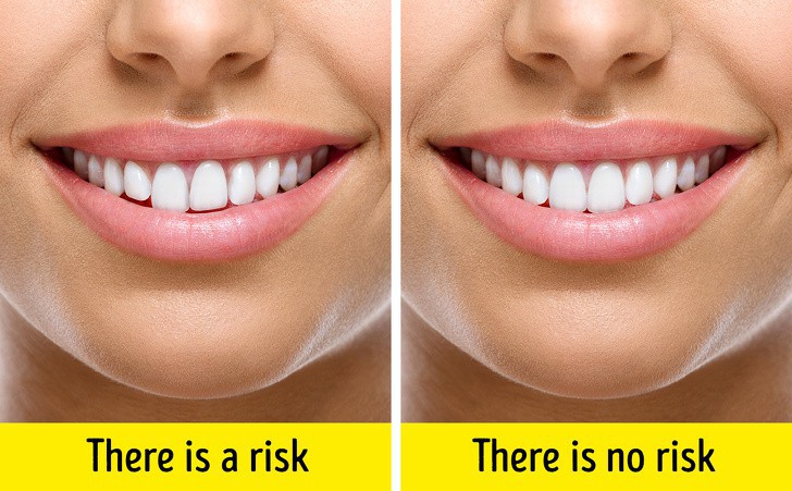 10 nguyên nhân khiến da mặt bị chảy xệ sớm - Ảnh 8.