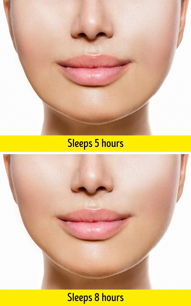 10 nguyên nhân khiến da mặt bị chảy xệ sớm - Ảnh 9.