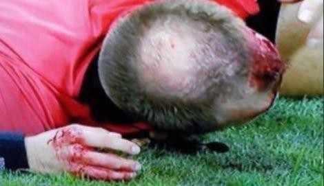Trọng tài biên Europa League bị ném vỡ đầu, chảy máu bê bết - Ảnh 1.