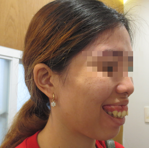 Mở băng sau cắt hàm, nữ công nhân không tin vào gương mặt mình - Ảnh 1.