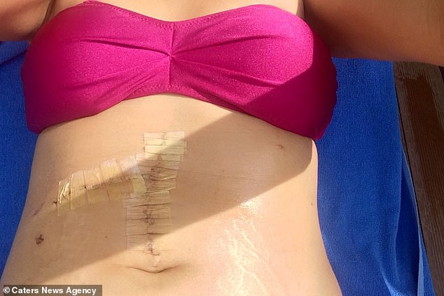 Chơi máng trượt nước, người phụ nữ bị đè vỡ gan suýt chết - Ảnh 1. Chơi máng trượt nước, người phụ nữ bị đè vỡ gan suýt chết - Ảnh 1.