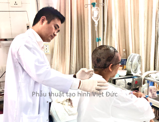 Người phụ nữ ở Hà Nội bị máy lột phăng da đầu và da vùng mặt - Ảnh 1.
