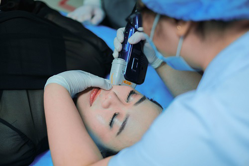 HIFU - Công nghệ nâng cơ, trẻ hóa, giảm béo 3 trong 1 - Ảnh 2. HIFU - Công nghệ nâng cơ, trẻ hóa, giảm béo 3 trong 1 - Ảnh 2.