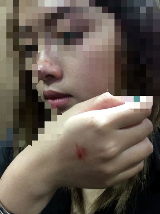 Giám đốc Công an Hà Nội lên tiếng vụ nữ sinh viên bị sàm sỡ trong thang máy - Ảnh 2.