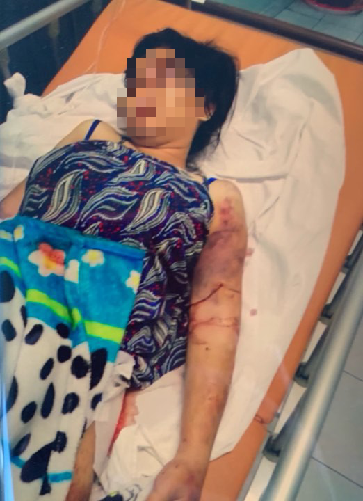 Tiết lộ chấn động từ thai phụ 18 tuổi bị tra tấn ở Bình Chánh - Ảnh 1.