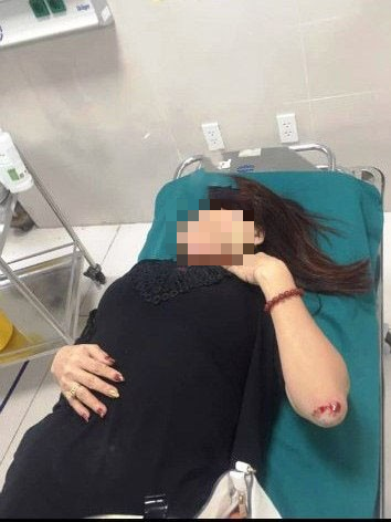 Vợ chồng nữ doanh nhân ở Quảng Bình tố bị xã hội đen dùng súng truy sát - Ảnh 1.