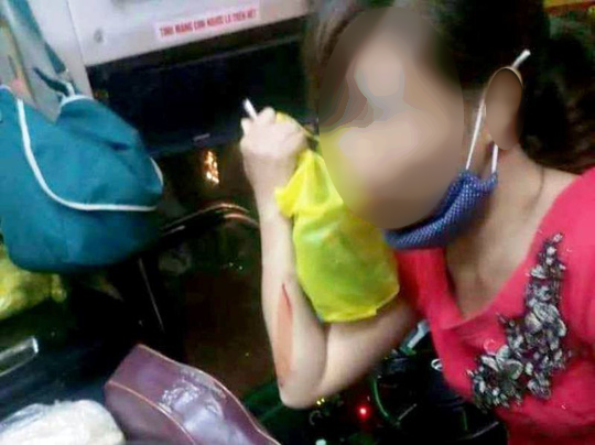 Truy tìm nhóm lạ mặt ném vỡ kính xe khách ở Thanh Hóa làm 1 phụ nữ bị thương - Ảnh 2.