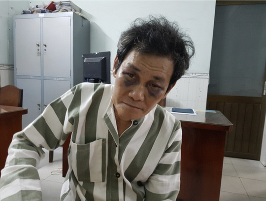 Tuyên án kẻ dâm ô bé gái 7 tuổi bị người dân bắt tại trận ở Bình Tân - Ảnh 2.