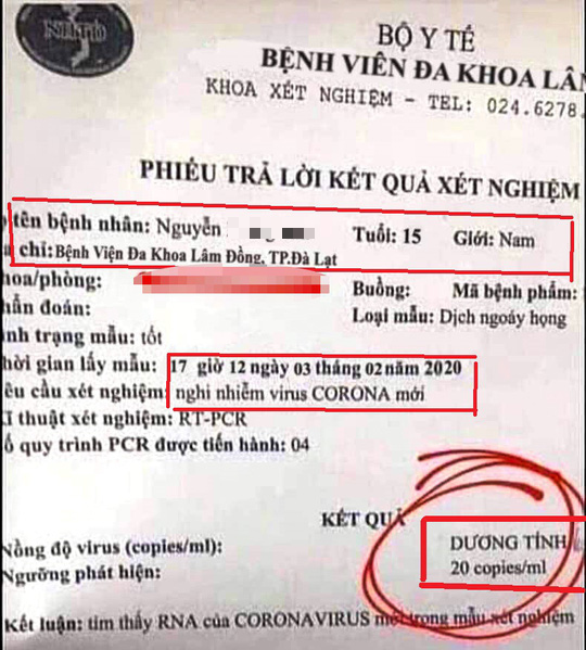 Hoang mang kết quả xét nghiệm dương tính với virus corona giả mạo ở Lâm Đồng - Ảnh 1.