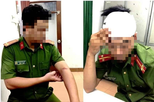 Hai công an phường ở Đà Nẵng bị tấn công khi làm nhiệm vụ - Ảnh 1.