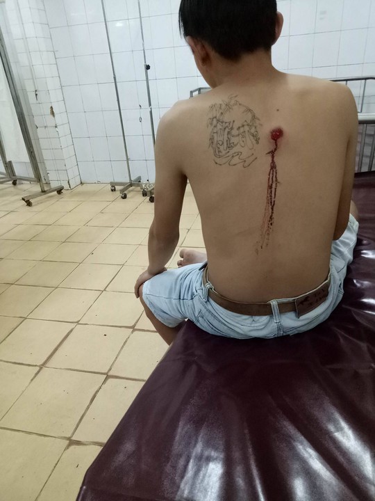 Công an xã bắn vào người đi đường
