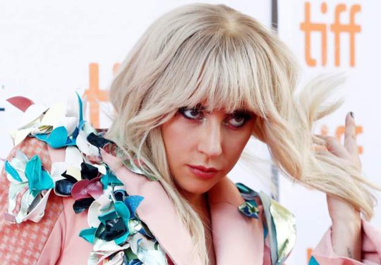 Lady Gaga hoãn lưu diễn đến 2018 vì đau xơ cơ - Ảnh 1.