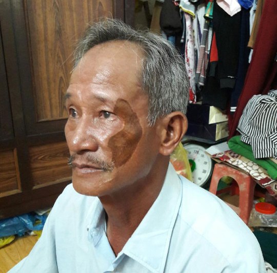 Ông Trần Châu Tuấn bị chém sau khi tố cáo mình bị tống tiền