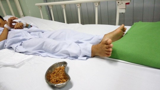 Lấy hơn 70 gram hạt sơ-ri nảy mầm trong hậu môn bé trai - Ảnh 1. Lấy hơn 70 gram hạt sơ-ri nảy mầm trong hậu môn bé trai - Ảnh 1.