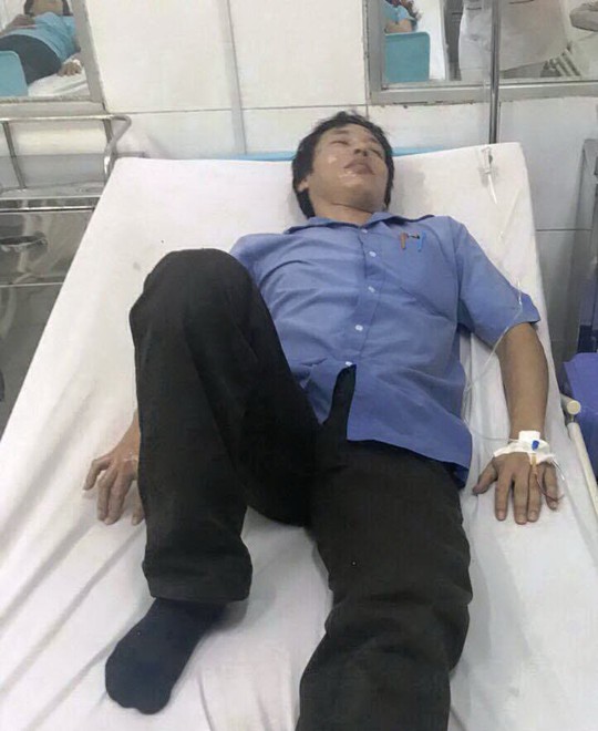 Đồng Nai: Nhiều công nhân bị bỏng do nổ lớn - Ảnh 1.