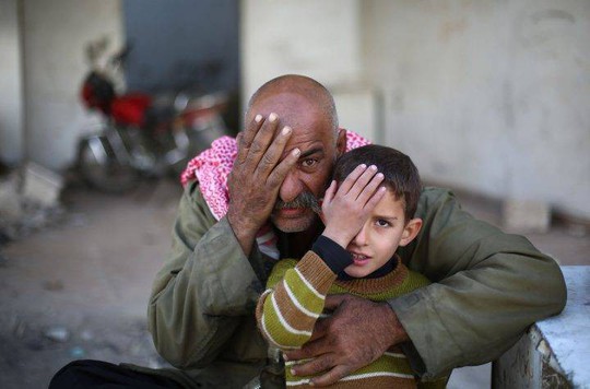 Syria: Xót thương bé 3 tháng tuổi chỉ còn một mắt - Ảnh 9.