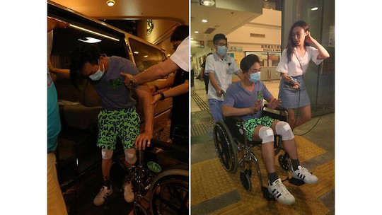 Diễn viên TVB bị xe tông khi đang quay phim - Ảnh 2.