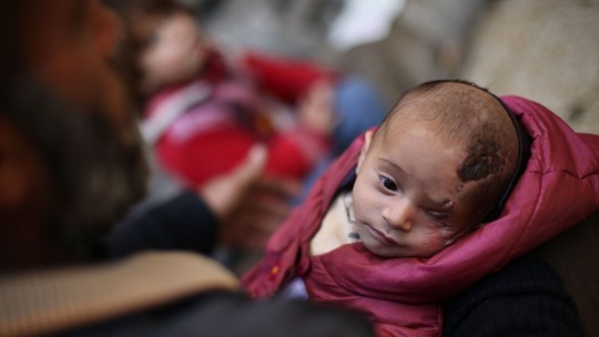 Syria: Xót thương bé 3 tháng tuổi chỉ còn một mắt - Ảnh 1.