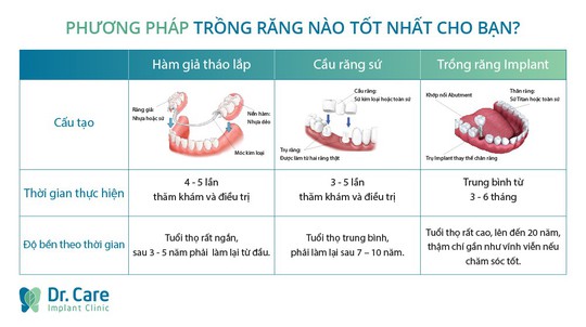 Ba lầm tưởng về phương pháp trồng răng Implant - Ảnh 1.