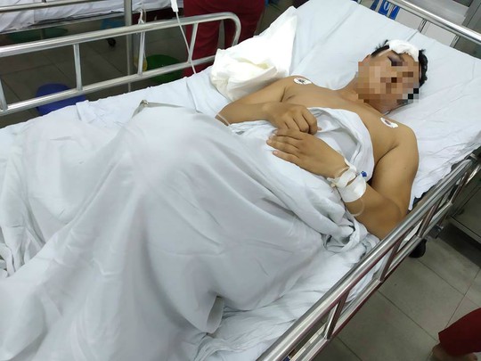 Công nhân Công ty Panko Tam Thăng bị đồng nghiệp đánh vỡ sọ - Ảnh 1.