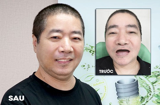 Bếp trưởng Đài Loan vượt ngàn dặm đến Việt Nam để làm răng  - Ảnh 1.