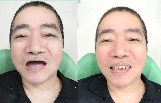 Bếp trưởng Đài Loan vượt ngàn dặm đến Việt Nam để làm răng  - Ảnh 2.