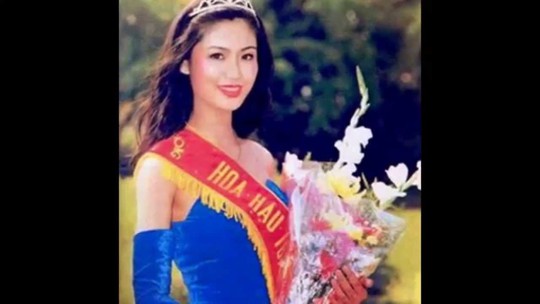 Hoa hậu Việt Nam 1994 Nguyễn  Thu Thủy thừa nhận sử dụng dao kéo - Ảnh 2.