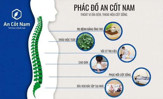 7 dấu hiệu thoát vị đĩa đệm lưng đặc trưng nhất định phải nhớ - Ảnh 5.