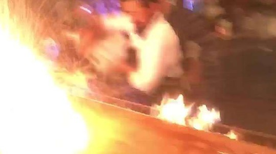 Nhà hàng biểu diễn quá tay, lửa táp thực khách bỏng nặng - Ảnh 4.