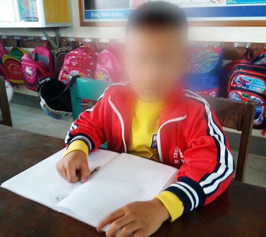 Vụ cô giáo tát học sinh lớp 1 nhập viện ở Quảng Bình: Công an vào cuộc - Ảnh 1.