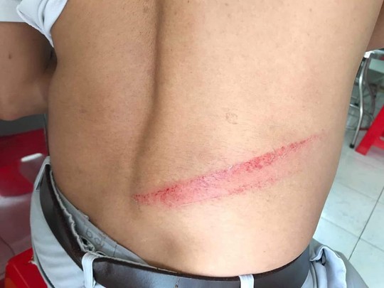 Thanh niên đánh người gần chốt CSGT: Tức vì bị đòi kiểm tra túi xách - Ảnh 2.