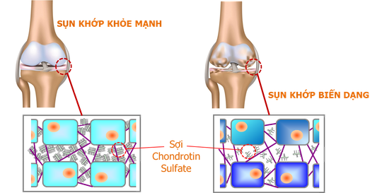 Chondro support - Sản phẩm hỗ trợ sụn khớp của người Nhật - Ảnh 2.