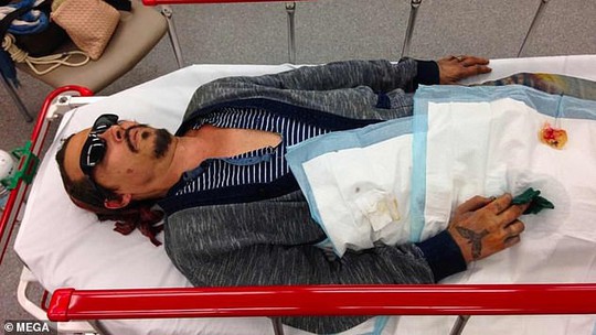 Cướp biển Johnny Depp tung ảnh thê thảm cáo buộc vợ cũ bạo hành - Ảnh 1.