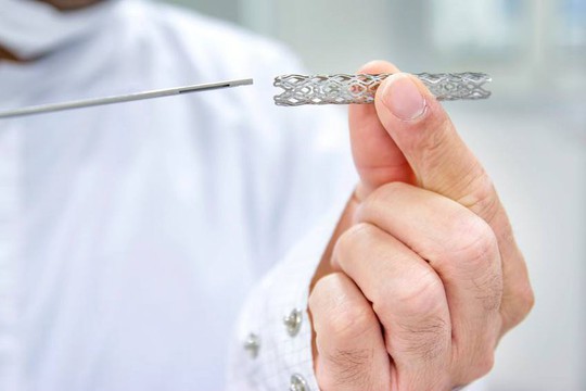 Đặt stent mạch vành, không lo “đội” chi phí - Ảnh 2.