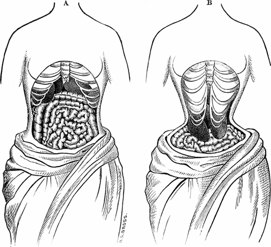 Thời trang nguy hiểm thời xưa - Ảnh 1.