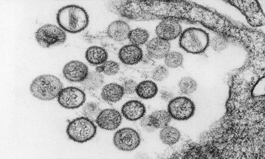 9 virus nguy hiểm trên trái đất - Ảnh 6.