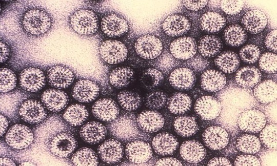 9 virus nguy hiểm trên trái đất - Ảnh 9.