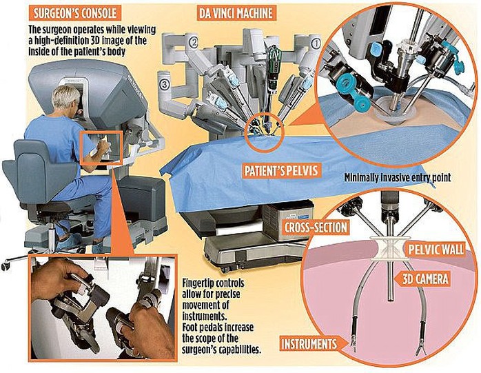 Robot cấy buồng trứng đông lạnh 11 năm cho cô gái bị ung thư  - Ảnh 1.