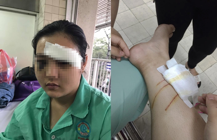 
Em Nguyễn Thị Ngọc Trúc đang được điều trị tại Bệnh viện Chợ Rẫy.
