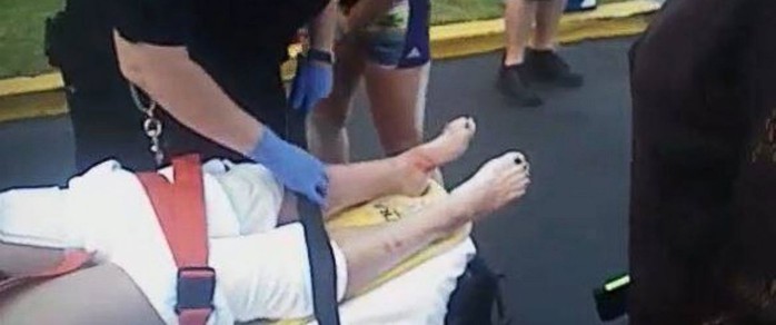 Nữ sinh 17 tuổi có nhiều vết cắn trên chân. Ảnh: Okaloosa County Sheriffs Office