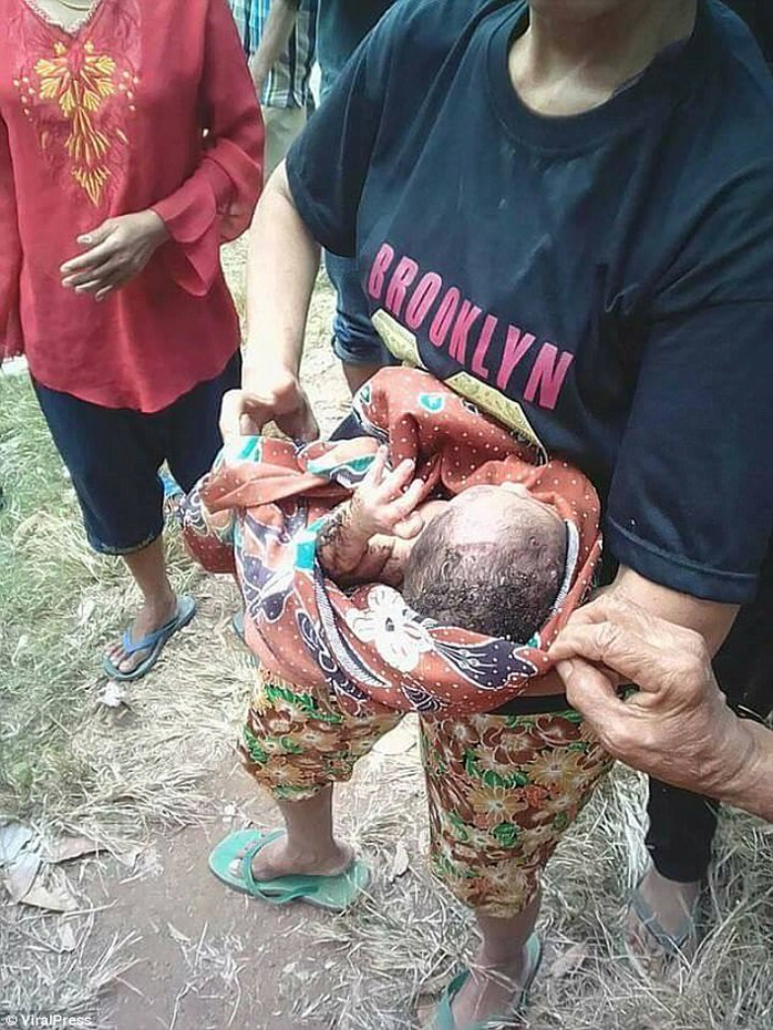 Indonesia: Cứu sống bé sơ sinh bị bỏ dưới hố rác - Ảnh 2.