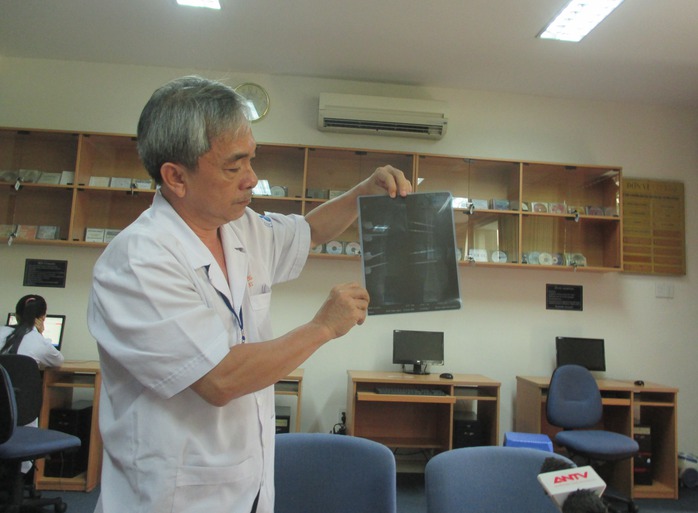 Chuyển viện xuyên biên giới, bé Campuchia được bác sĩ Việt cứu sống - Ảnh 1.