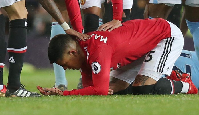 Rojo khoe chấn thương ghê rợn sau trận gặp Man City - Ảnh 2.